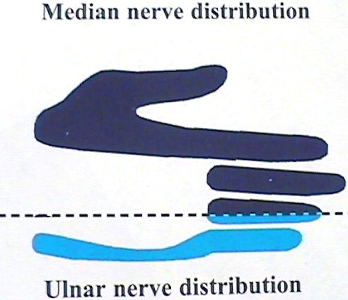 ulnar nerve diagram