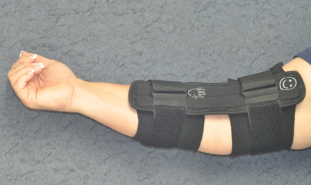An arm stretched out where a brace is wrapped around the lower half of the forearm